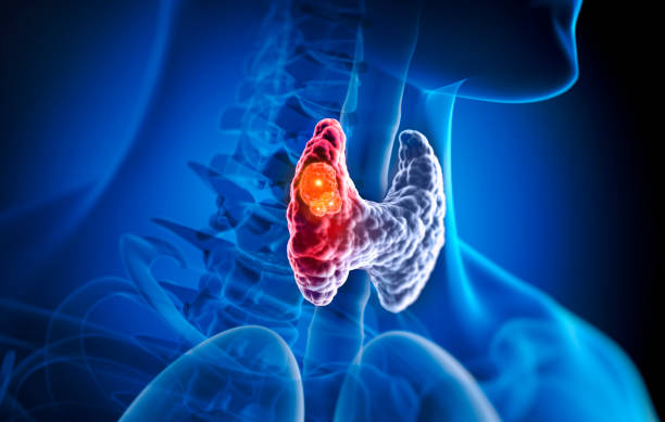 A pajzsmirigy betegségek holisztikus megközelítése